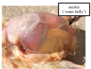 Water belly or ascites
